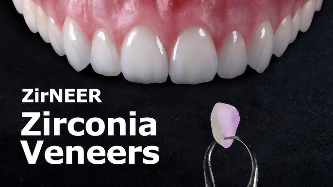 zirconia veneers